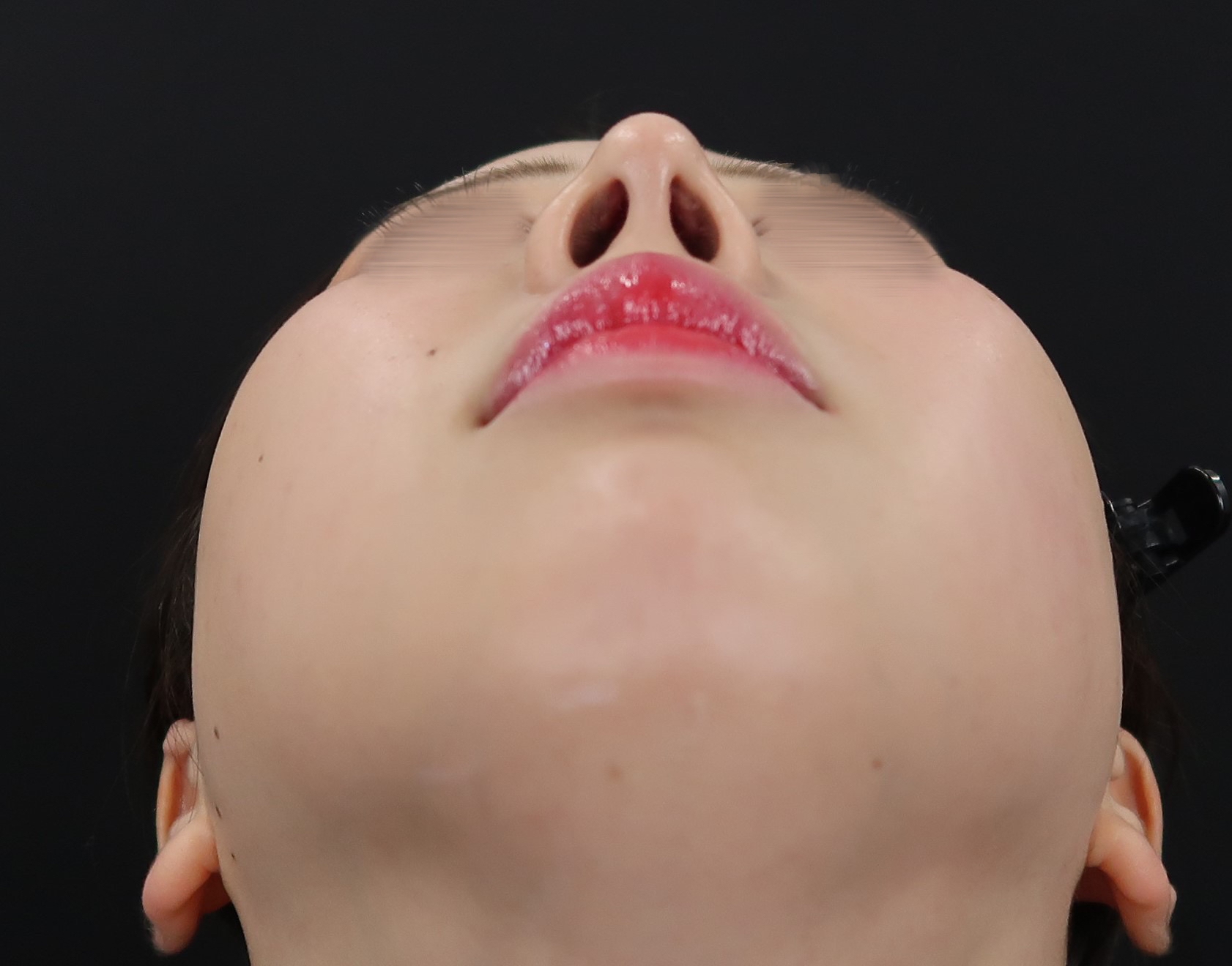pic
