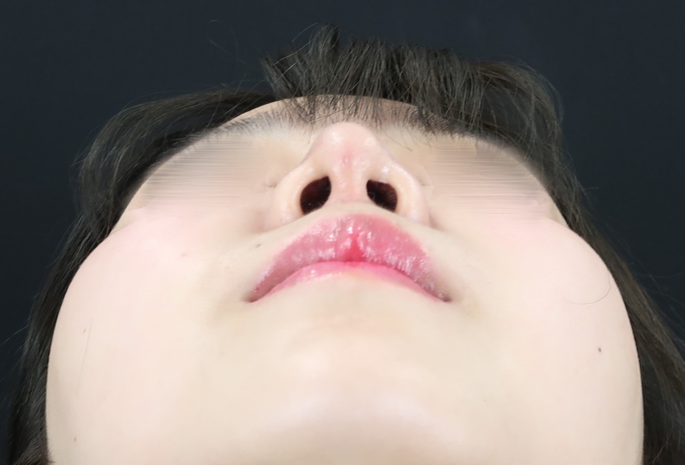pic