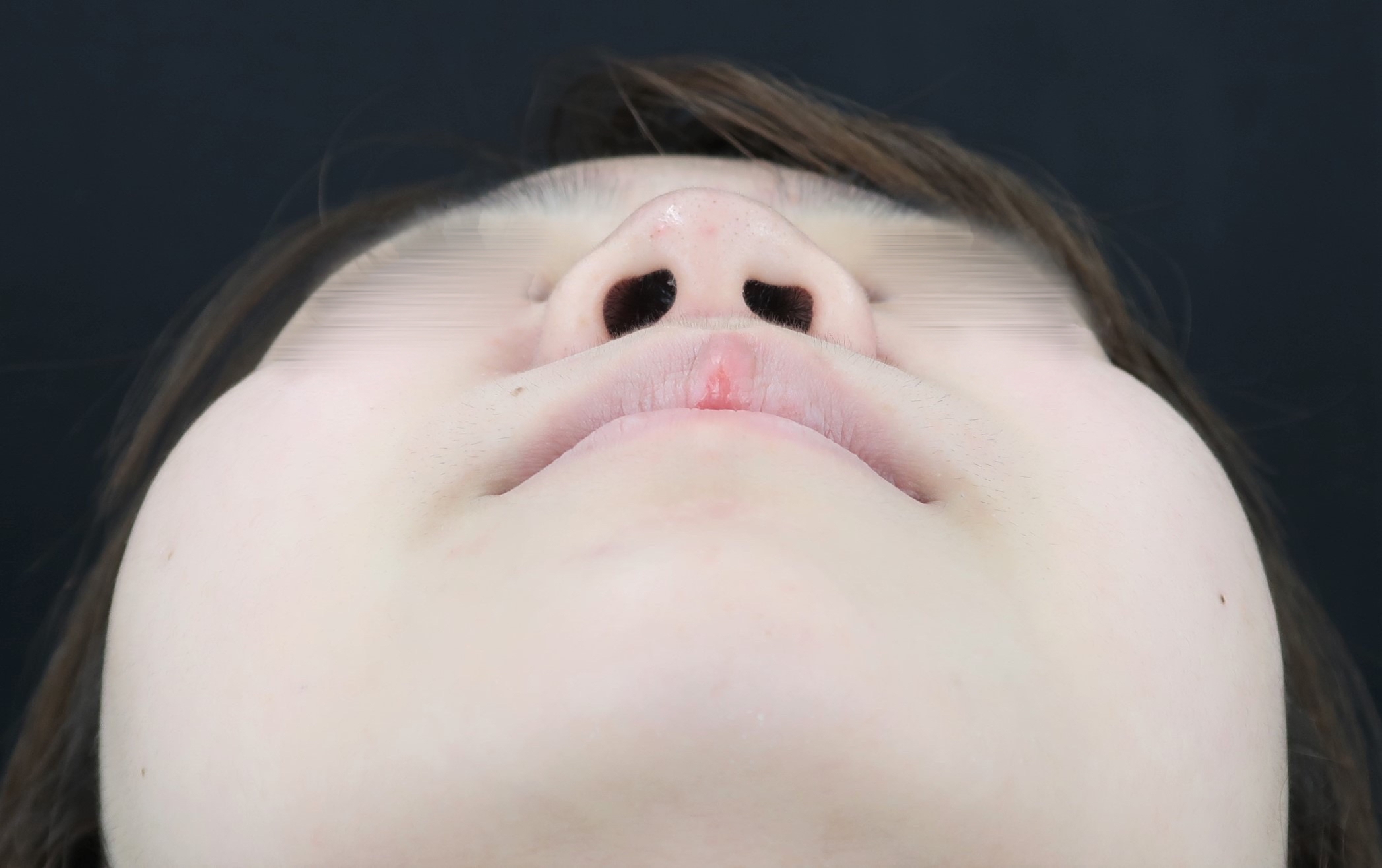 pic