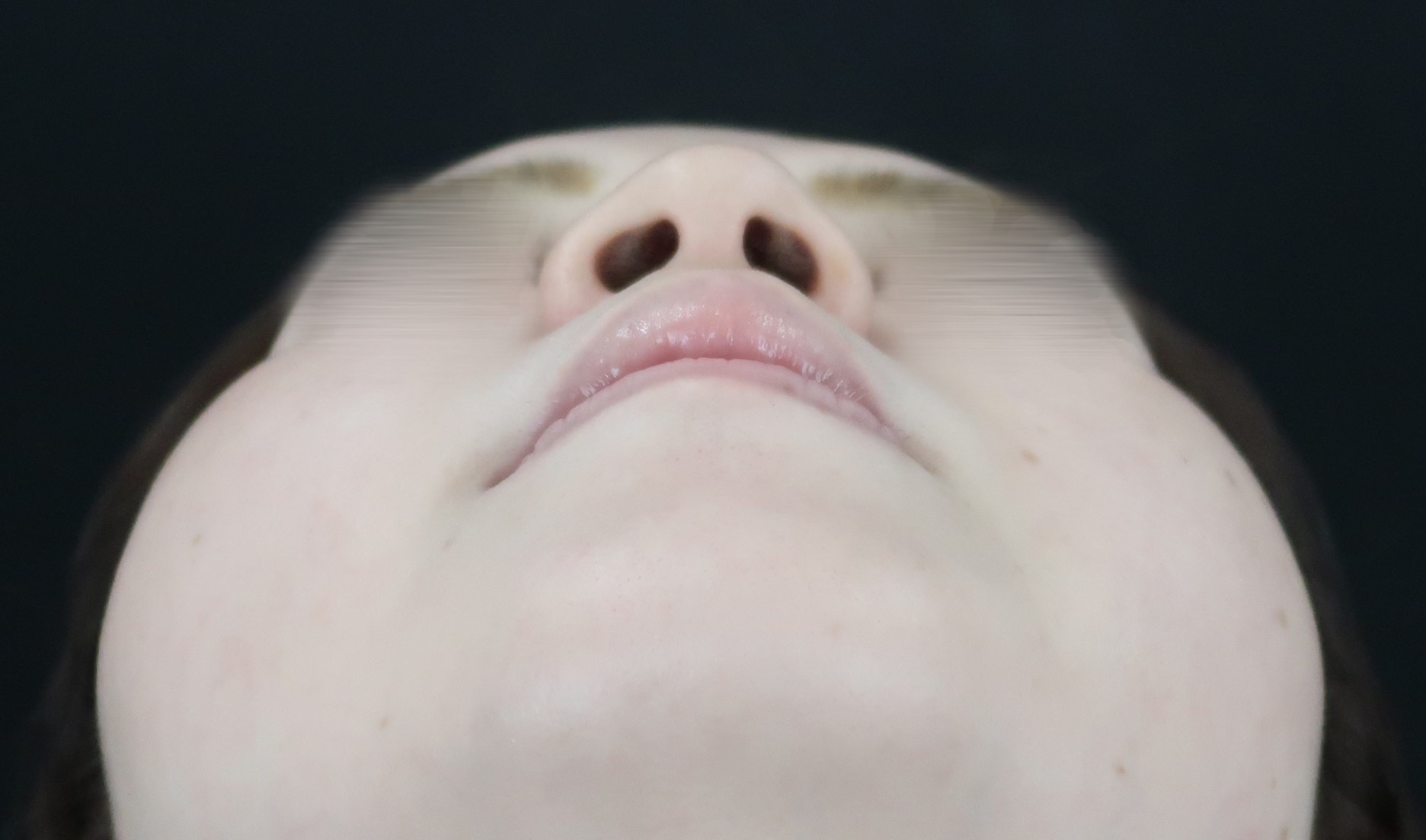 pic