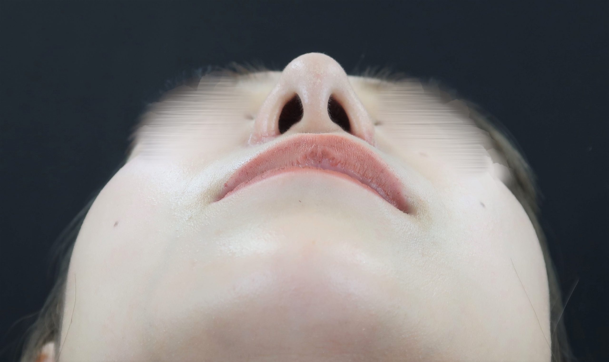 pic