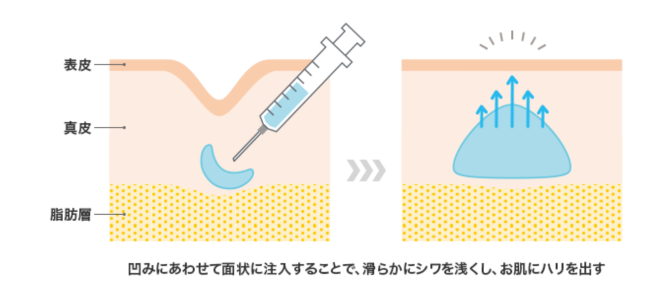 ヒアルロン酸の仕組み図