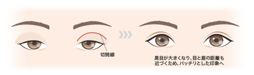 施術イメージのイラスト